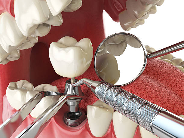 Best Emergency Wisdom Teeth Removal in Ancient Oaks, PA